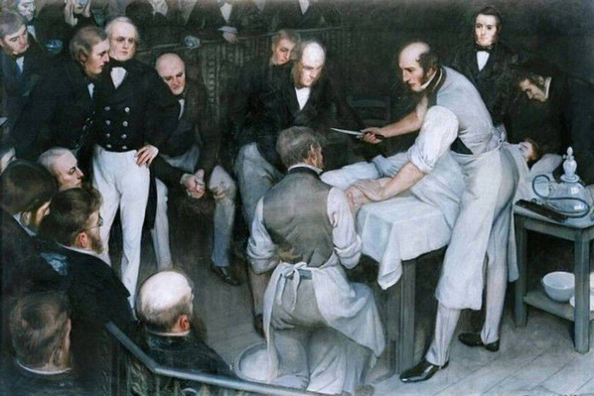 Ilustración de Robert Liston en el quirófano