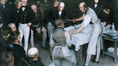 Imagen de Robert Liston en acción, amputando una pierna con su característico estilo y velocidad