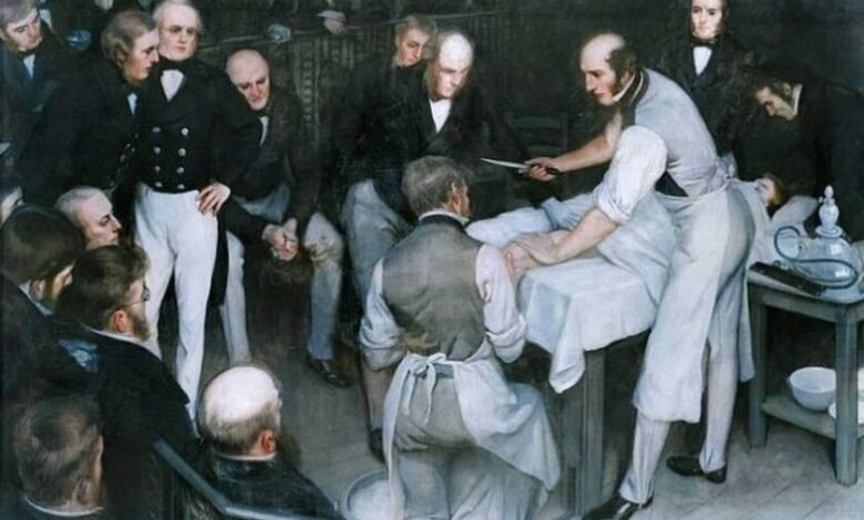 Imagen de Robert Liston en acción, amputando una pierna con su característico estilo y velocidad