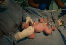 Sangre del cordón umbilical en un frasco de almacenamiento