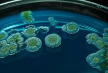 Imagen de un hongo bajo el microscopio