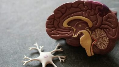 Ilustración de un cerebro humano con áreas afectadas por el Alzheimer