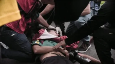 Fotografía de Pablo Grillo después de ser herido por una granada de gas lacrimógeno