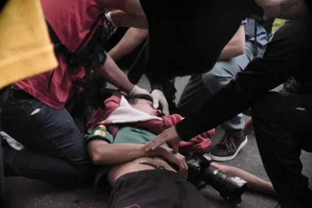 Fotografía de Pablo Grillo después de ser herido por una granada de gas lacrimógeno