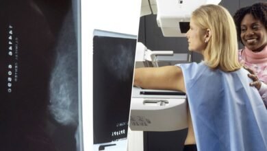 Mujer realizándose una mamografía con ayuda de inteligencia artificial