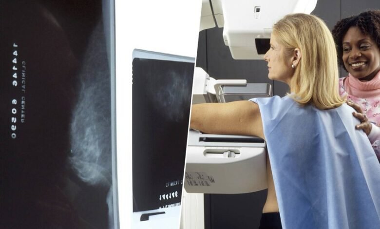 Mujer realizándose una mamografía con ayuda de inteligencia artificial