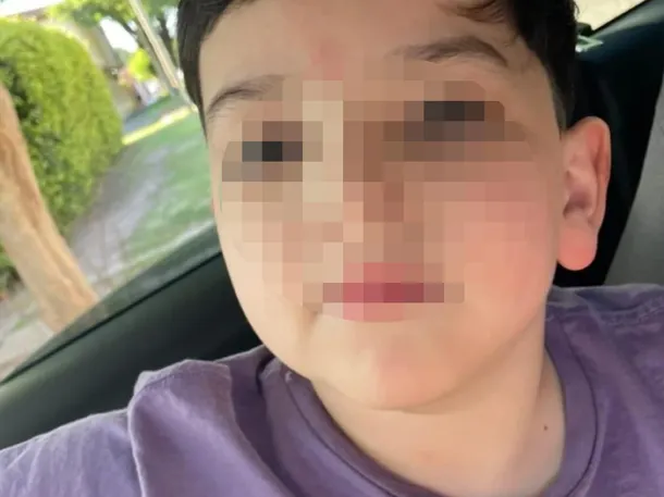 Bastian, el nene accidentado en Pinamar