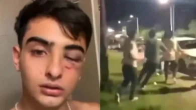 Imagen de un joven herido en un ataque en Tafí del Valle
