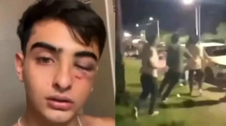 Imagen de un joven herido en un ataque en Tafí del Valle