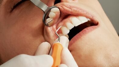 Imagen de una bacteria dental