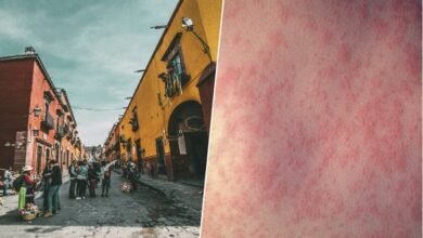 Gráficos de casos de sarampión en México