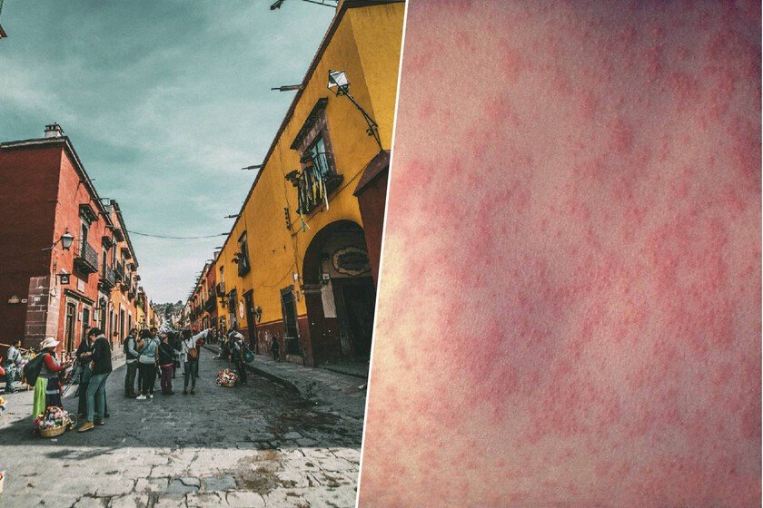 Gráficos de casos de sarampión en México