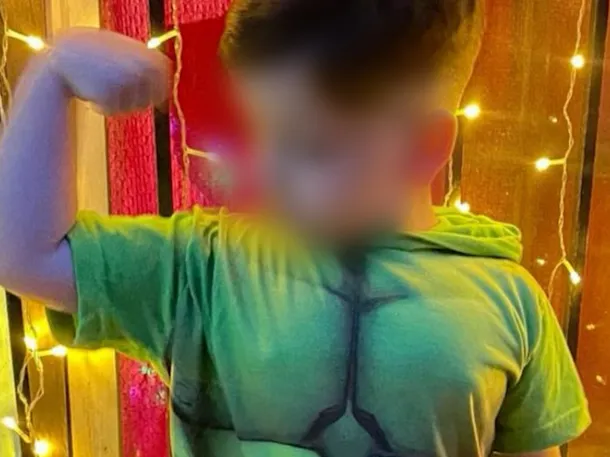 Bastian Jerez sonriendo después de despertar de su coma