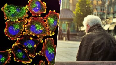 Células humanas bajo un microscopio, con una célula senescente en el centro