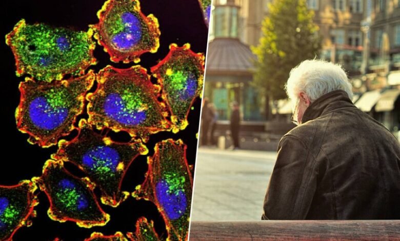 Células humanas bajo un microscopio, con una célula senescente en el centro