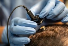 Imagen de un implante cerebral siendo colocado en el cerebro, representando la integración de la tecnología con el cuerpo humano.