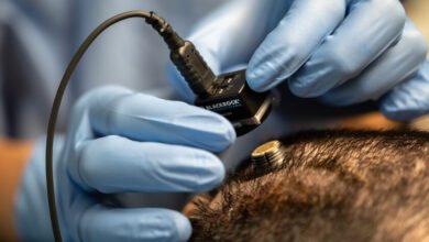 Imagen de un implante cerebral siendo colocado en el cerebro, representando la integración de la tecnología con el cuerpo humano.