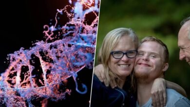 Ilustración del cromosoma 21 y su relación con el síndrome de Down