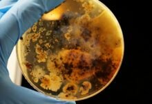 Imagen de un hongo en una superficie hospitalaria