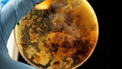 Imagen de un hongo bajo el microscopio