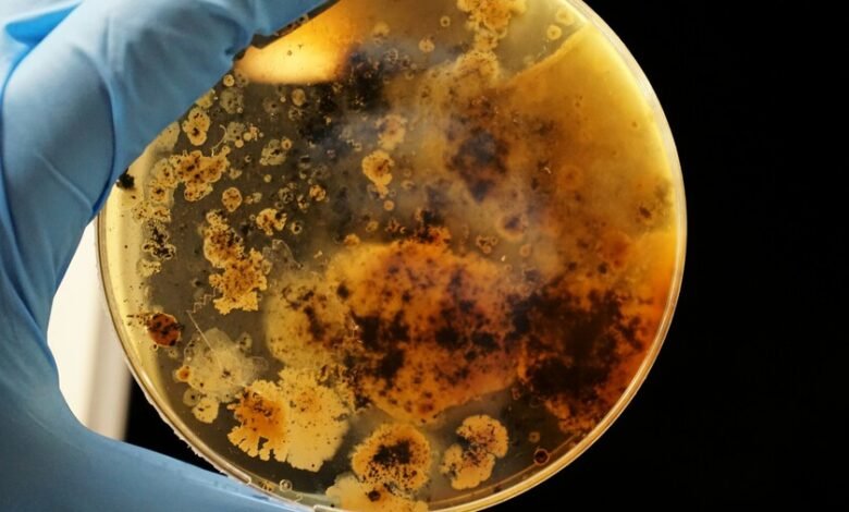 Imagen de un hongo bajo el microscopio