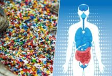 Imagen de microplásticos en el intestino humano