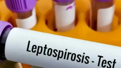 Imágenes de leptospirosis y síntomas