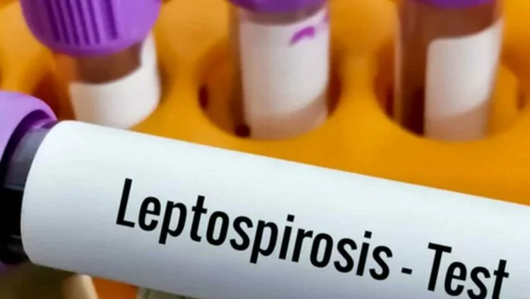 Imágenes de leptospirosis y síntomas