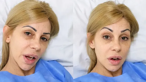 Mónica Farro en una imagen después de su operación