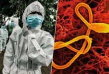 Imagen de un equipo médico trabajando en un hospital de África central