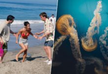 Una persona con una picadura de medusa en la pierna