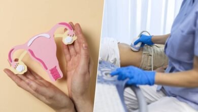 Mujer con síntomas de síndrome de ovario poliquístico