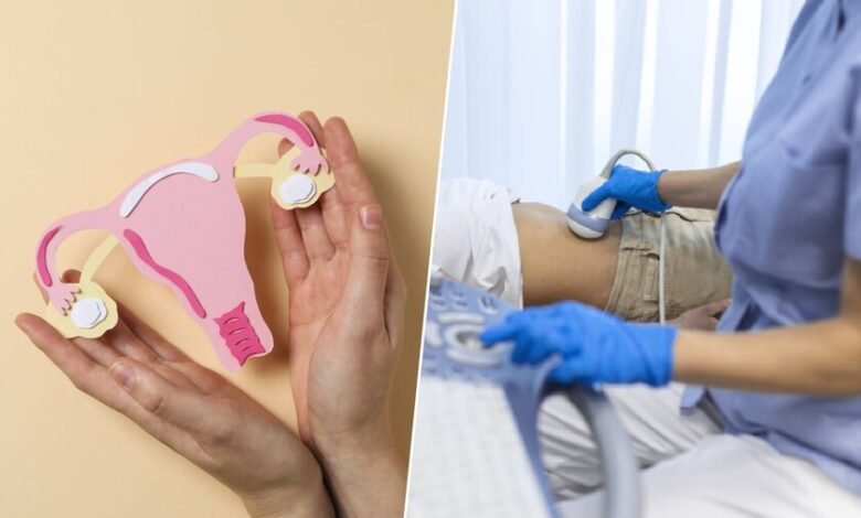 Mujer con síntomas de síndrome de ovario poliquístico