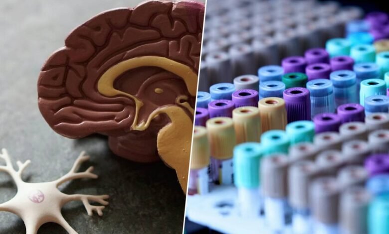 Imagen de un cerebro humano iluminado, simbolizando la esperanza en la lucha contra el alzhéimer