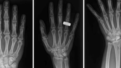 Astronautas tomando radiografías en órbita