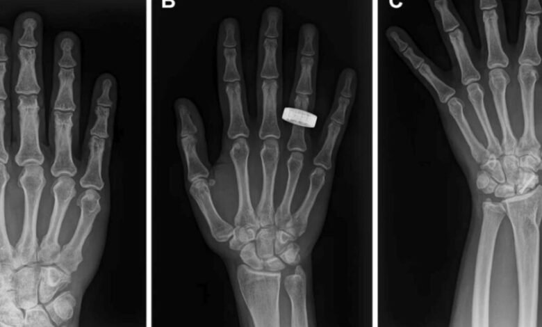 Astronautas tomando radiografías en órbita