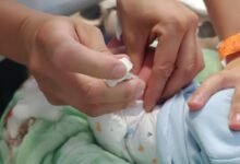 Recién nacido recibiendo atención médica