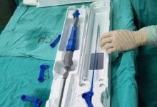 Equipo médico realizando un implante de válvula aórtica transcatéter en el Nuevo Hospital San Roque