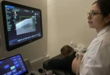 Transductor de alta frecuencia de 15 MHz para ecografía dermatológica en el Hospital San Roque