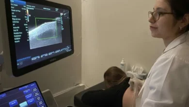 Transductor de alta frecuencia de 15 MHz para ecografía dermatológica en el Hospital San Roque