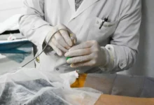 Sala de tomografía del Hospital Tránsito Cáceres de Allende durante ablación por radiofrecuencia