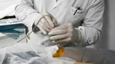 Sala de tomografía del Hospital Tránsito Cáceres de Allende durante ablación por radiofrecuencia
